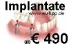 ZAHN-Behandlung CZ -günstiger als Ungarn- Implantate 490 €