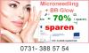 Micro Needling Schulung in Ulm.