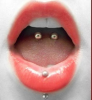 Antares-Piercing München, Tattoo und Tattooentfernung